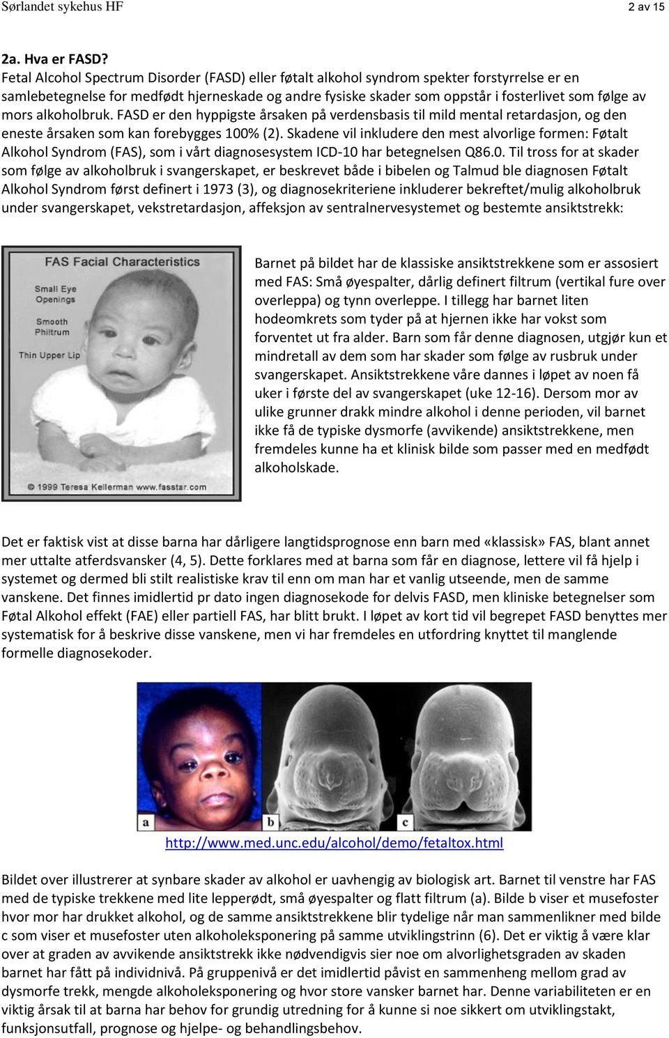 mors alkoholbruk. FASD er den hyppigste årsaken på verdensbasis til mild mental retardasjon, og den eneste årsaken som kan forebygges 100% (2).