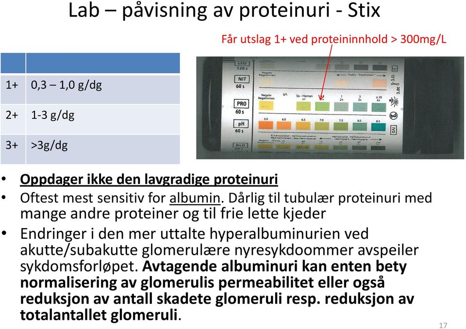 Dårlig til tubulær proteinuri med mange andre proteiner og til frie lette kjeder Endringer i den mer uttalte hyperalbuminurien ved