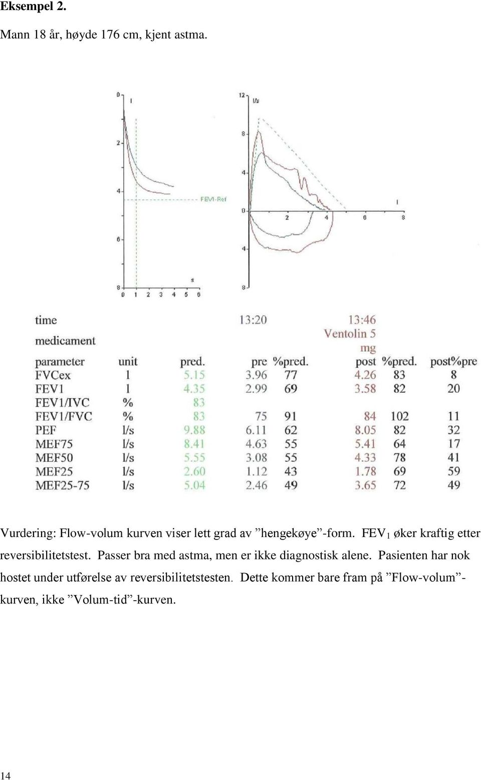 FEV 1 øker kraftig etter reversibilitetstest.