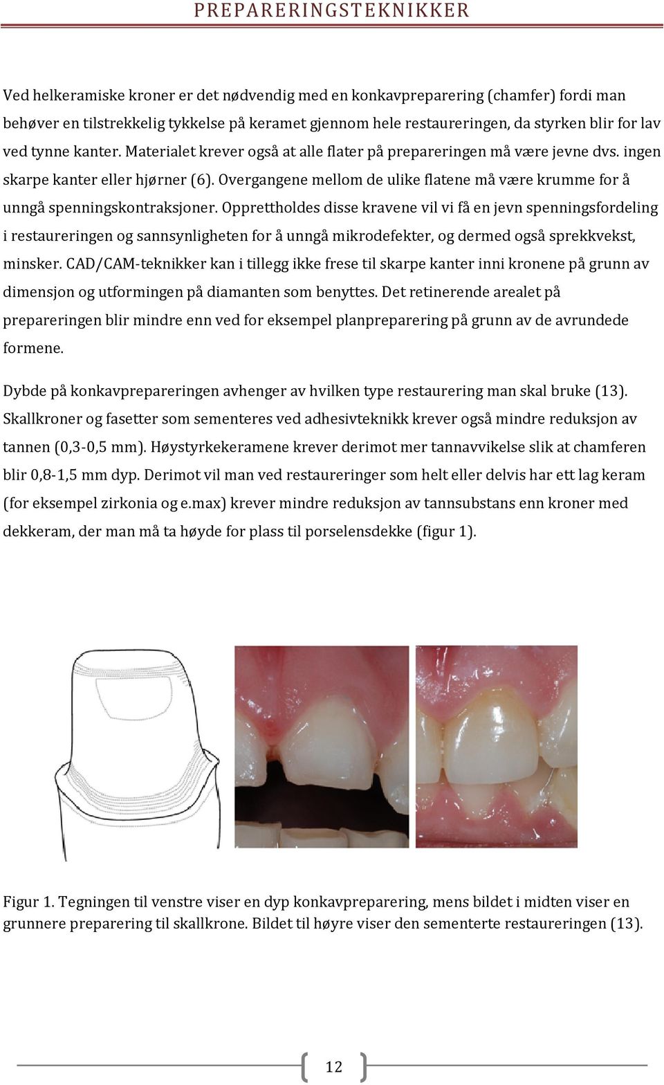 Overgangene mellom de ulike flatene må være krumme for å unngå spenningskontraksjoner.