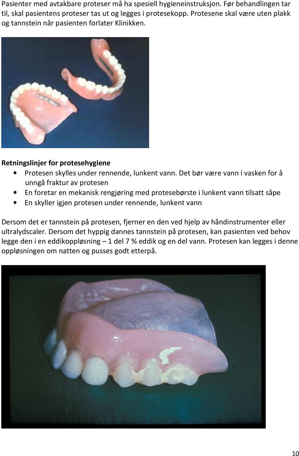 Det bør være vann i vasken for å unngå fraktur av protesen En foretar en mekanisk rengjøring med protesebørste i lunkent vann tilsatt såpe En skyller igjen protesen under rennende, lunkent vann