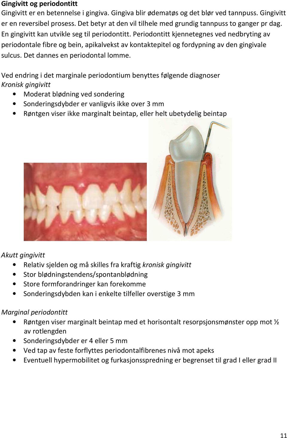 Periodontitt kjennetegnes ved nedbryting av periodontale fibre og bein, apikalvekst av kontaktepitel og fordypning av den gingivale sulcus. Det dannes en periodontal lomme.