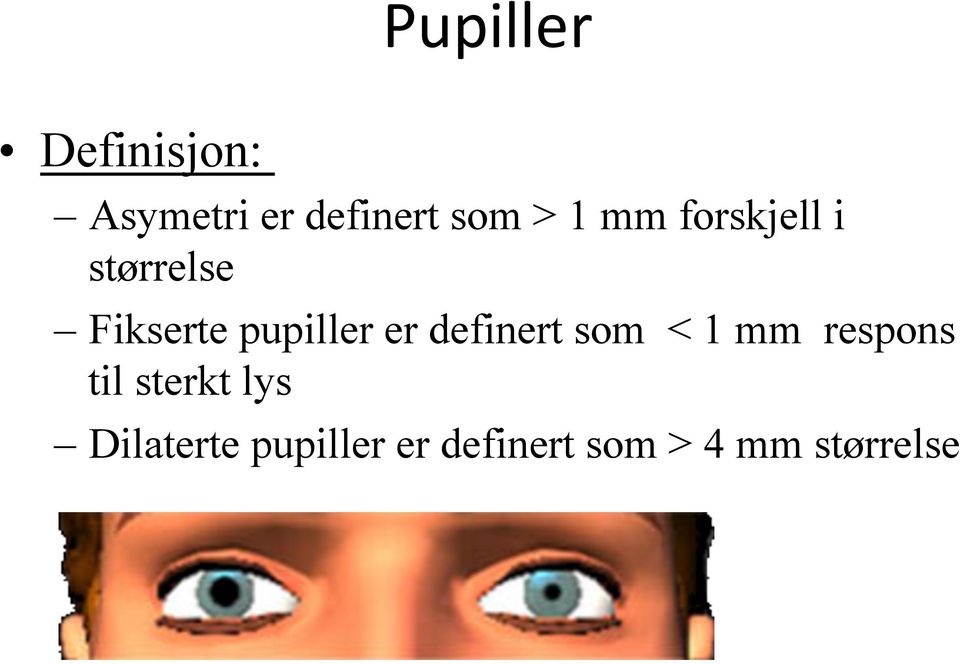 definert som < 1 mm respons til sterkt lys