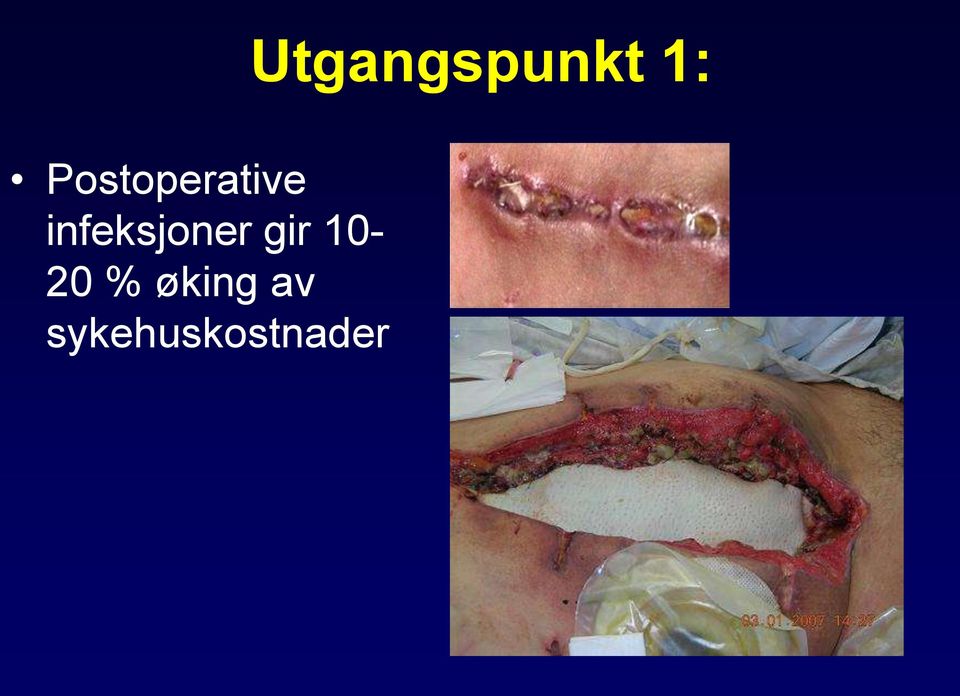 10-20 % øking av