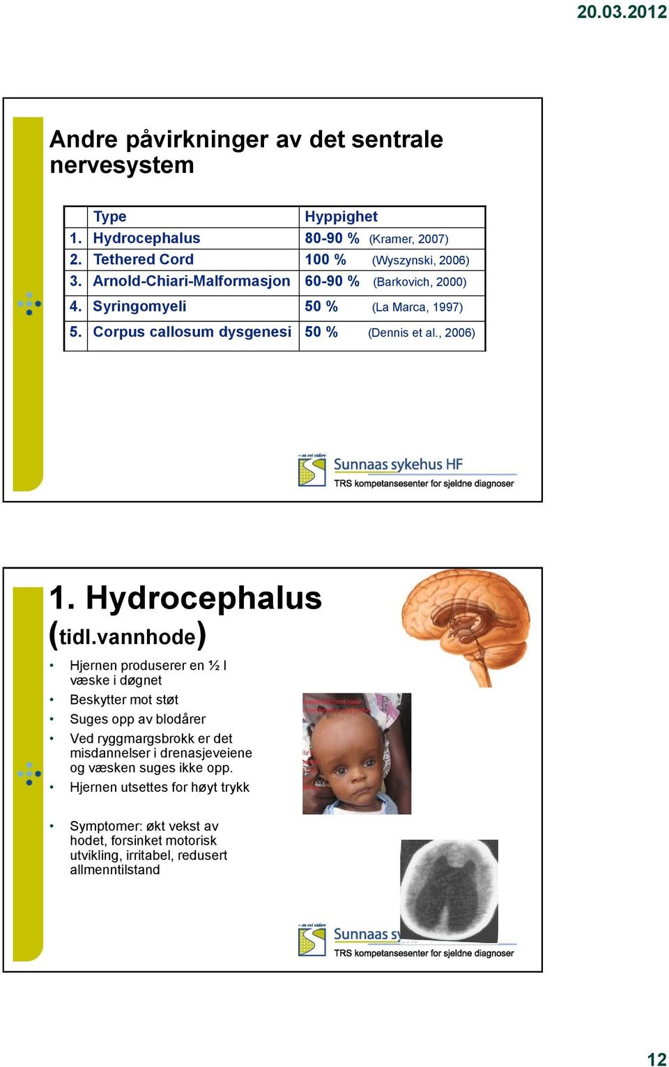 Hydrocephalus (tidl.