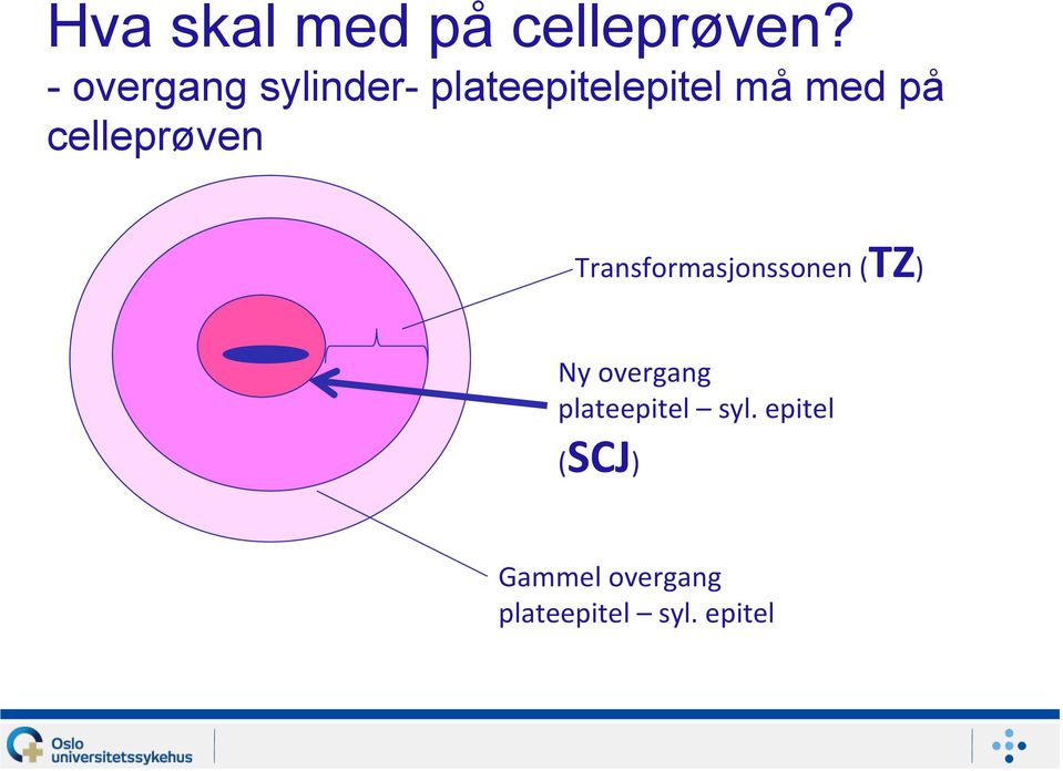 celleprøven Transformasjonssonen (TZ) Ny overgang