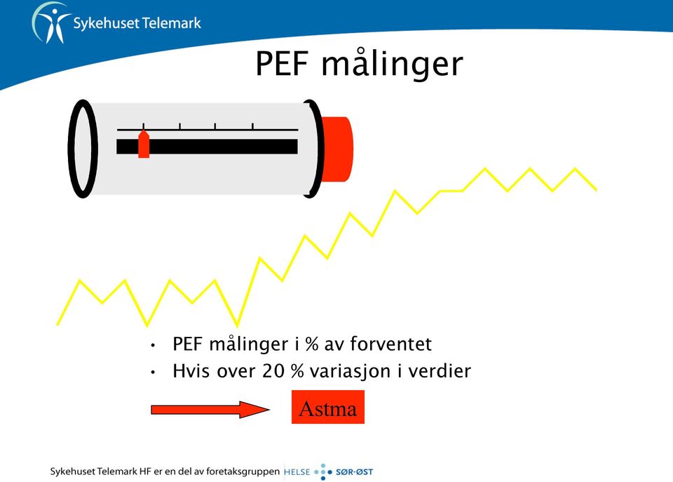 forventet Hvis over