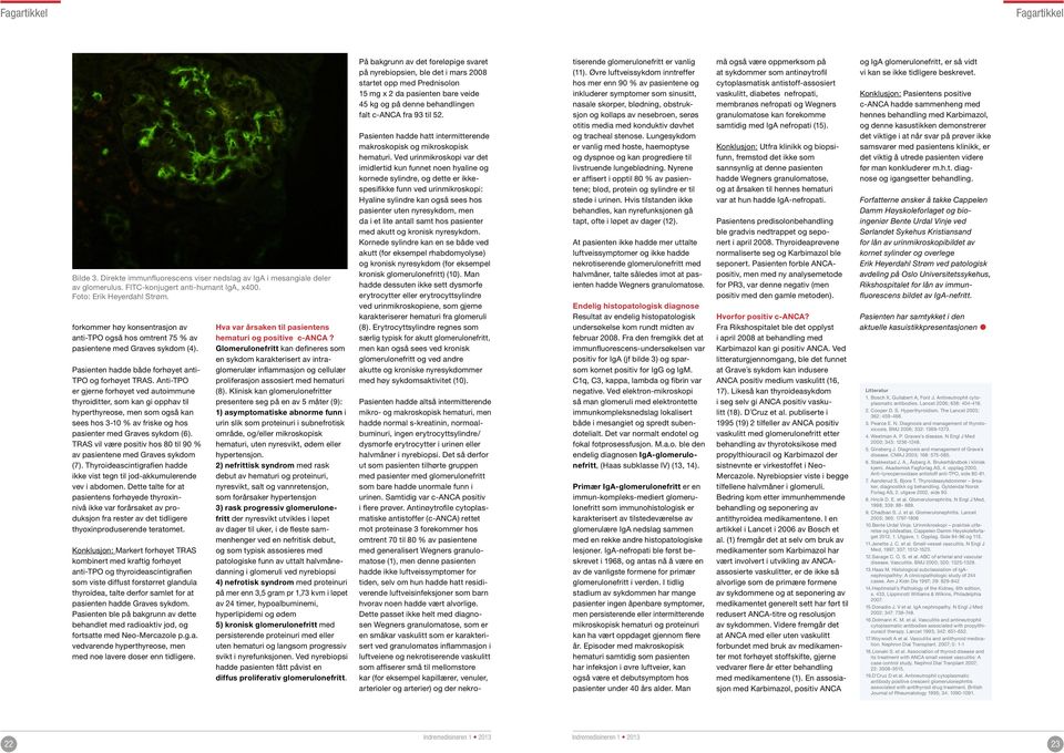 Anti-TPO er gjerne forhøyet ved autoimmune thyroiditter, som kan gi opphav til hyperthyreose, men som også kan sees hos 3-10 % av friske og hos pasienter med Graves sykdom (6).