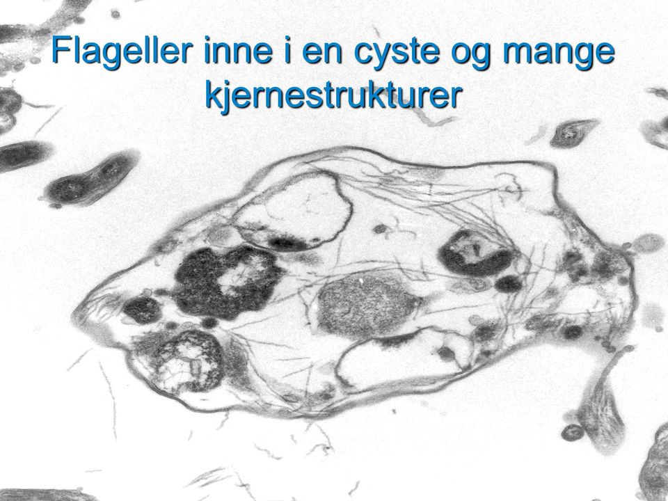 cyste og