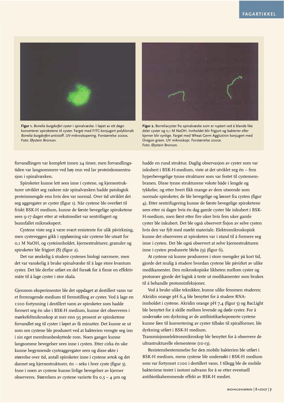 Innholdet blir frigjort og bakterier eller kjerner blir synlige. Farget med Wheat Germ Agglutinin konjugert med Oregon green. UV mikroskopi. Forstørrelse 2000x.