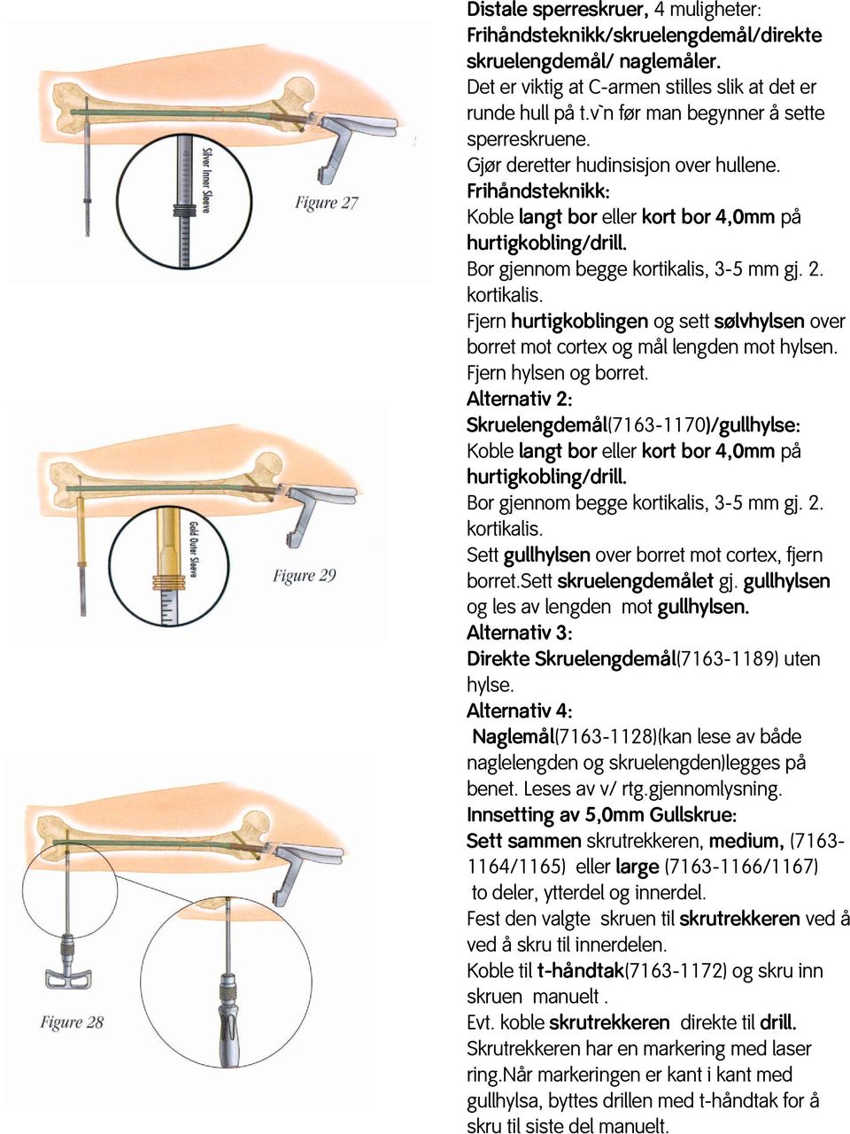 Bor gjennom begge kortikalis, 3-5 mm gj. 2. kortikalis. Fjern hurtigkoblingen og sett sølvhylsen over borret mot cortex og mål lengden mot hylsen. Fjern hylsen og borret.