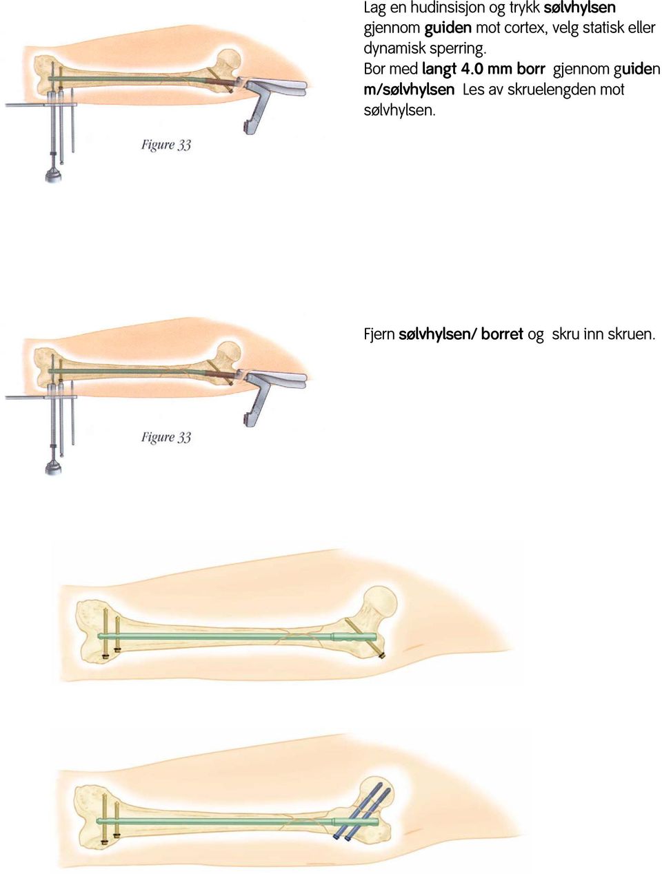 Bor med langt 4.