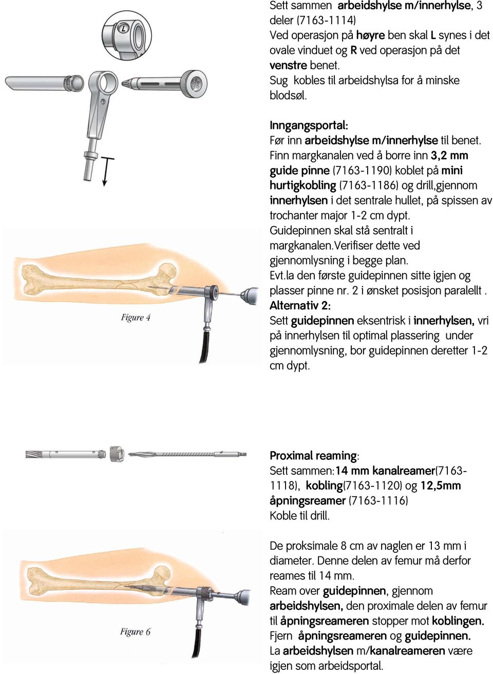 Finn margkanalen ved å borre inn 3,2 mm guide pinne (7163-1190) koblet på mini hurtigkobling (7163-1186) og drill,gjennom innerhylsen i det sentrale hullet, på spissen av trochanter major 1-2 cm dypt.