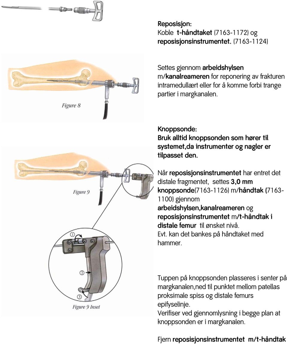 Knoppsonde: Bruk alltid knoppsonden som hører til systemet,da instrumenter og nagler er tilpasset den.