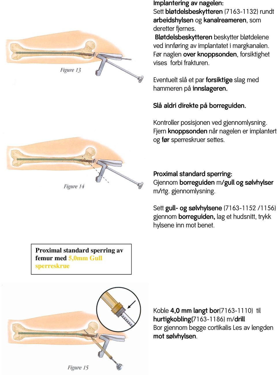 Eventuelt slå et par forsiktige slag med hammeren på innslageren. Slå aldri direkte på borreguiden. Kontroller posisjonen ved gjennomlysning.