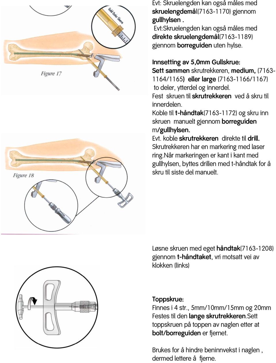 Koble til t-håndtak(7163-1172) og skru inn skruen manuelt gjennom borreguiden m/gullhylsen. Evt. koble skrutrekkeren direkte til drill. Skrutrekkeren har en markering med laser ring.