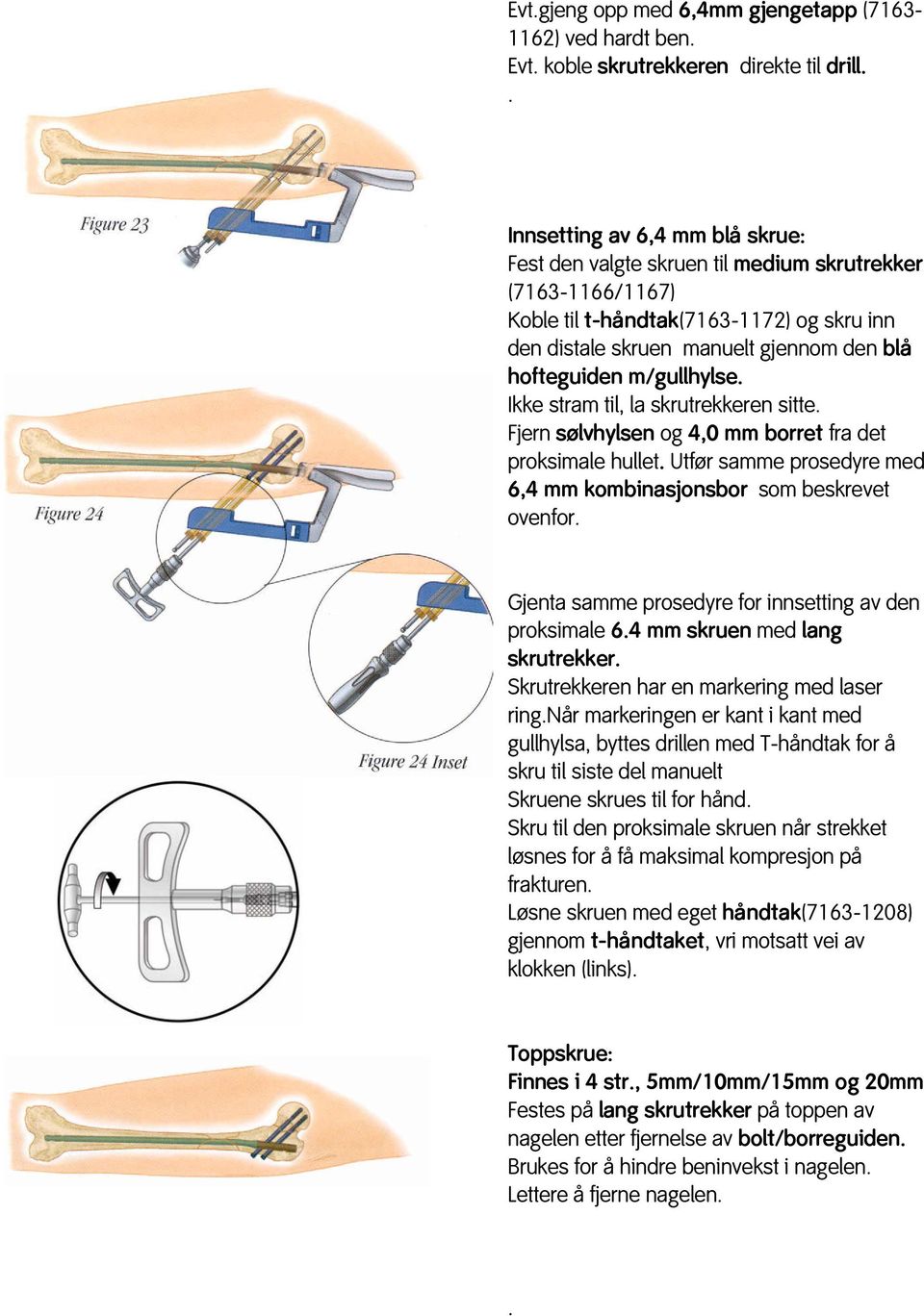 m/gullhylse. Ikke stram til, la skrutrekkeren sitte. Fjern sølvhylsen og 4,0 mm borret fra det proksimale hullet. Utfør samme prosedyre med 6,4 mm kombinasjonsbor som beskrevet ovenfor.