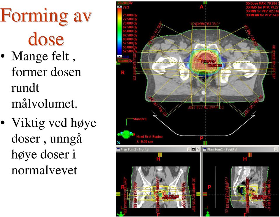 målvolumet.