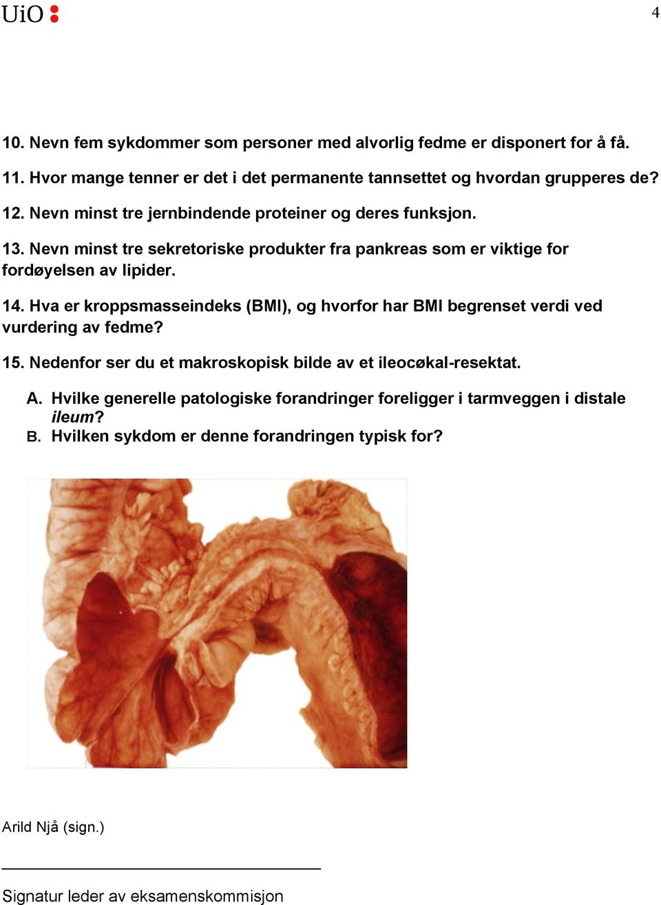 Hva er kroppsmasseindeks (BMI), og hvorfor har BMI begrenset verdi ved vurdering av fedme? 15. Nedenfor ser du et makroskopisk bilde av et ileocøkal-resektat. A.