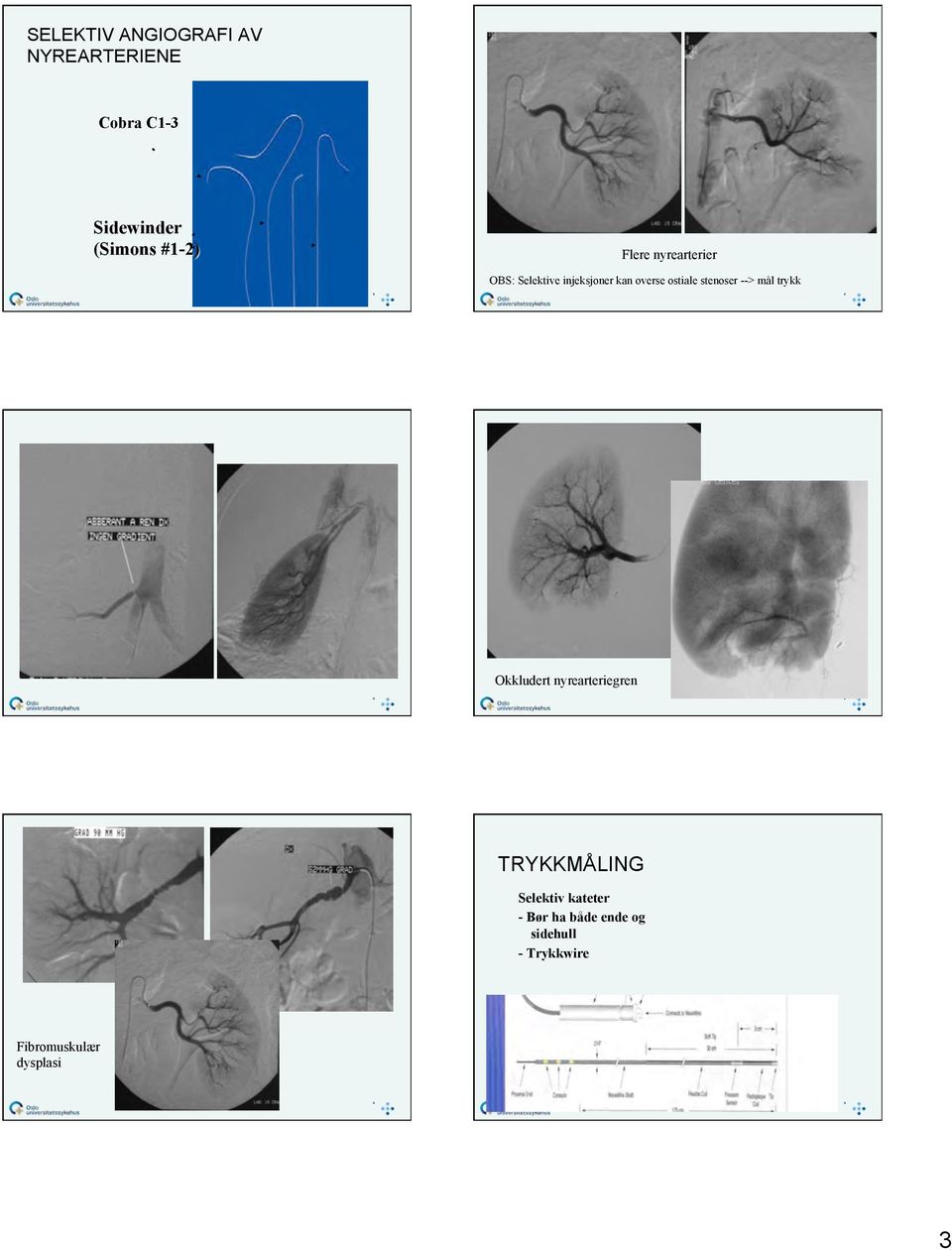 stenoser --> mål trykk Okkludert nyrearteriegren TRYKKMÅLING Selektiv