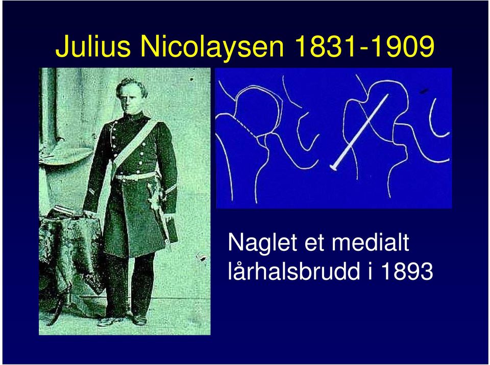 1831-1909 Naglet