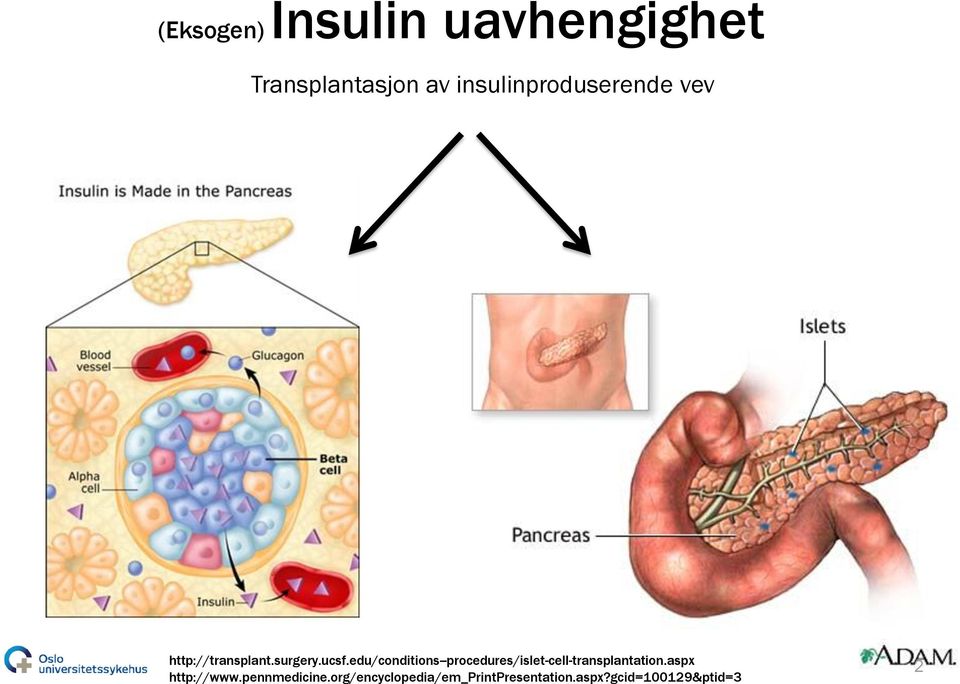 edu/conditions--procedures/islet-cell-transplantation.