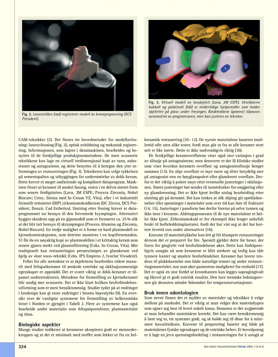 Bindeleddene (grønne) tilpasses automatisk av programvaren, men kan justeres av tekniker. CAM-teknikker (2). Det finnes tre hovedmetoder for modellavlesning: laseravlesning (Fig.