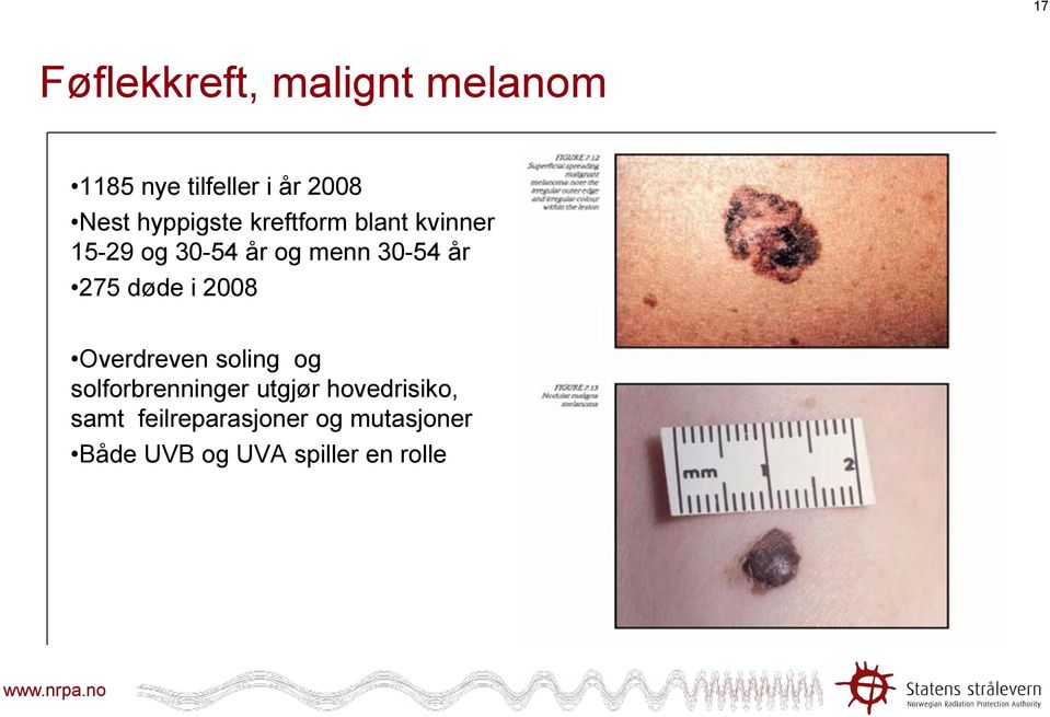 275 døde i 2008 Overdreven soling og solforbrenninger utgjør