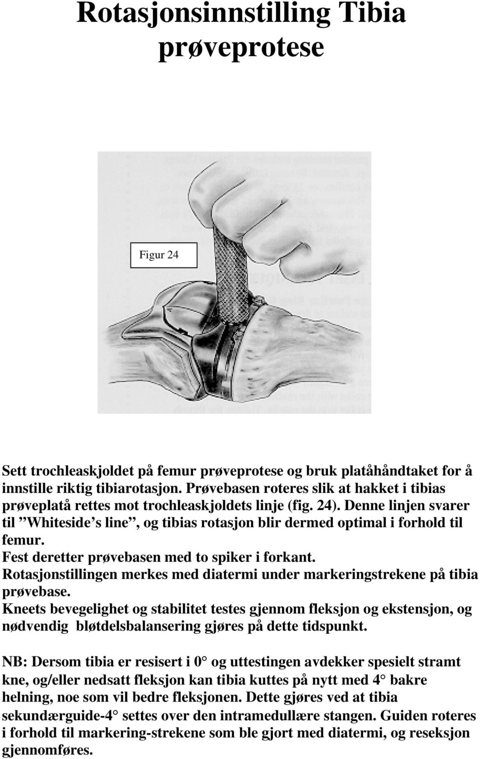 Denne linjen svarer til Whiteside s line, og tibias rotasjon blir dermed optimal i forhold til femur. Fest deretter prøvebasen med to spiker i forkant.