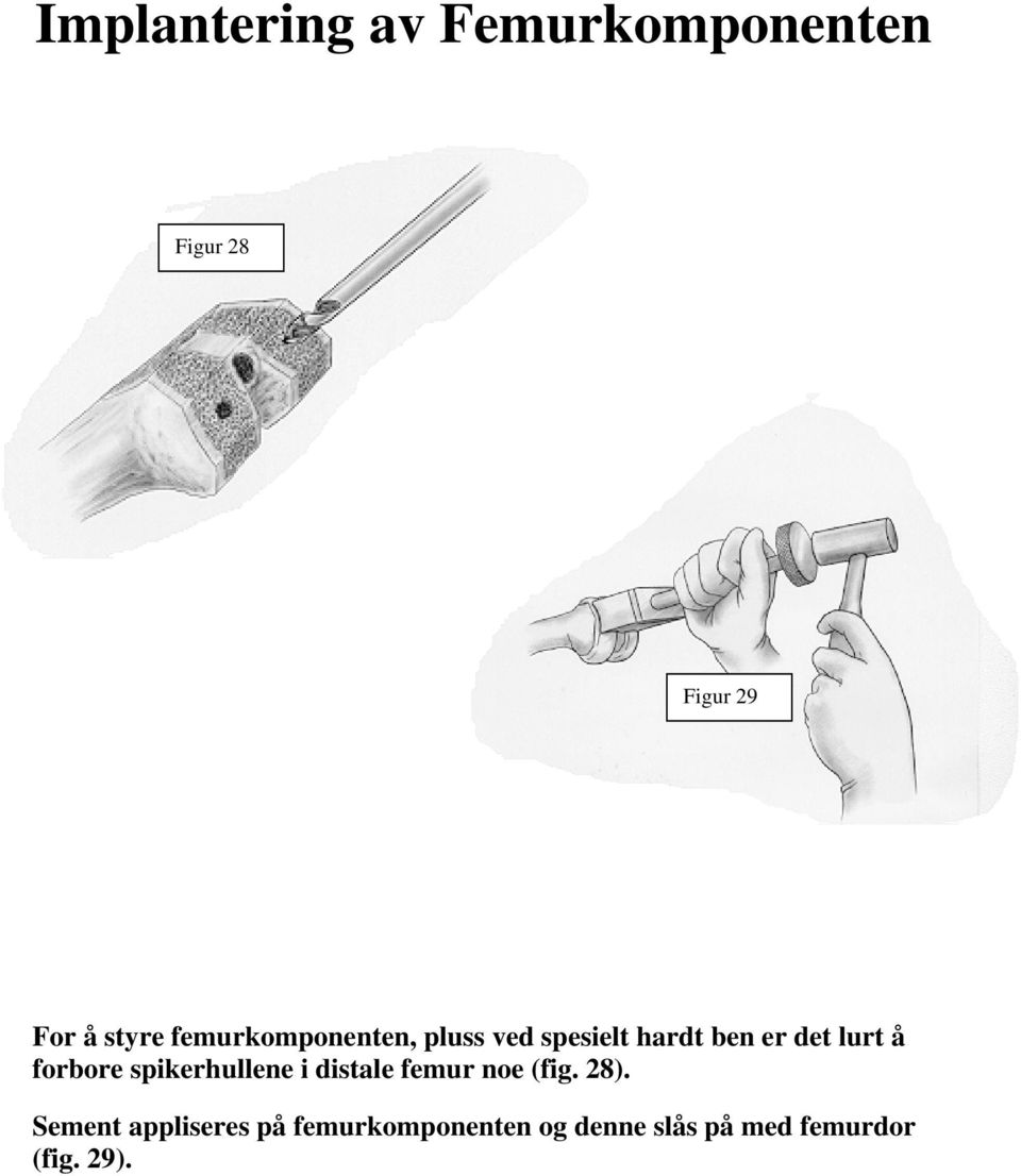 forbore spikerhullene i distale femur noe (fig. 28).