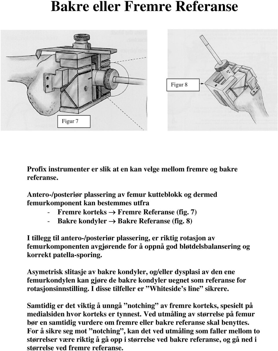 8) I tillegg til antero-/posteriør plassering, er riktig rotasjon av femurkomponenten avgjørende for å oppnå god bløtdelsbalansering og korrekt patella-sporing.