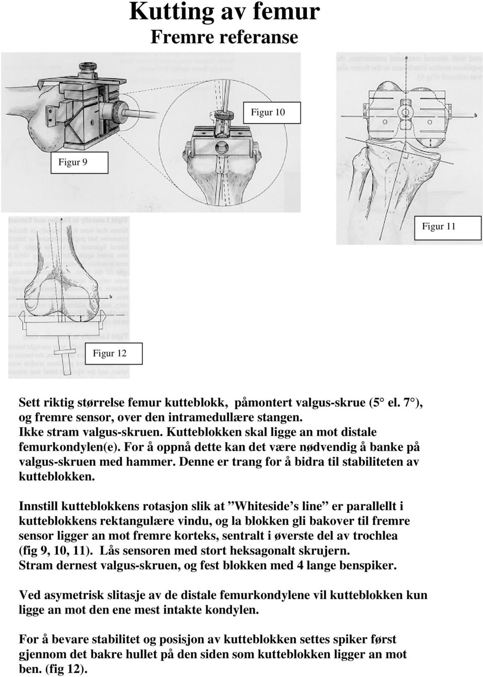 Denne er trang for å bidra til stabiliteten av kutteblokken.