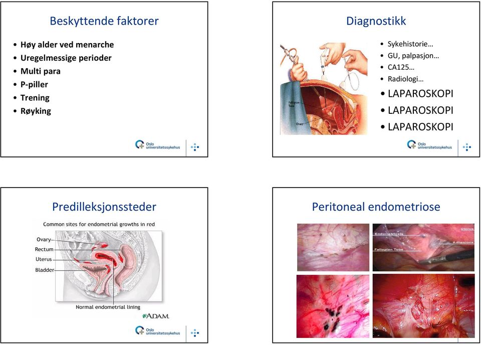 Radiologi LAPAROSKOPI LAPAROSKOPI LAPAROSKOPI Predilleksjonssteder