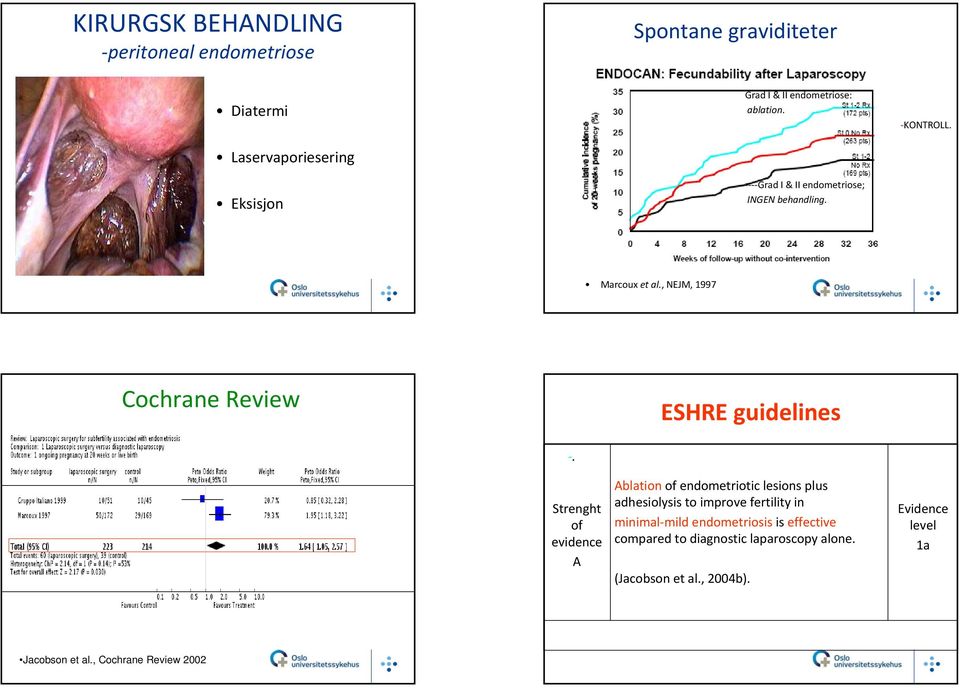 . Strenght of evidence A Ablation of endometriotic lesions plus adhesiolysis to improve fertility in minimal mild endometriosis