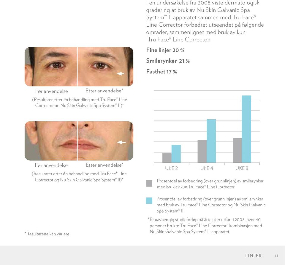 Galvanic Spa System II)* Før anvendelse Etter anvendelse* (Resultater etter én behandling med Tru Face Line Corrector og Nu Skin Galvanic Spa System II)* *Resultatene kan variere.