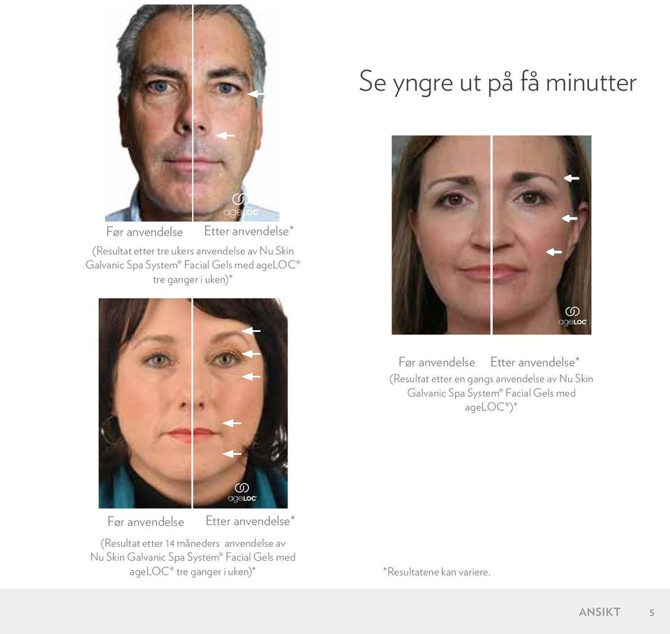 anvendelse av Nu Skin Galvanic Spa System Facial Gels med ageloc )* Før anvendelse Etter anvendelse* (Resultat etter 14