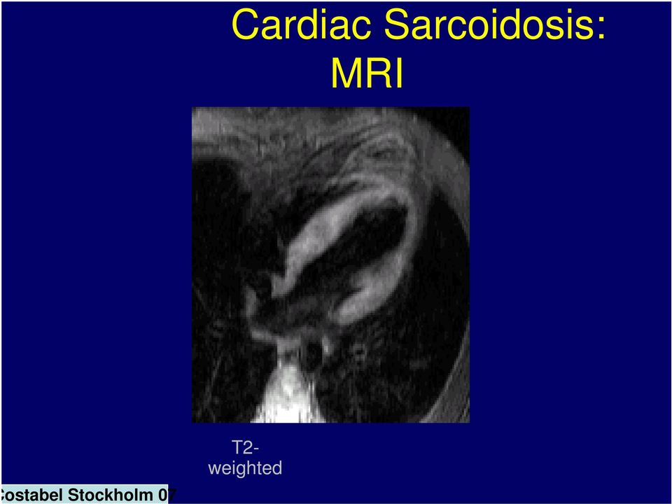 MRI Costabel