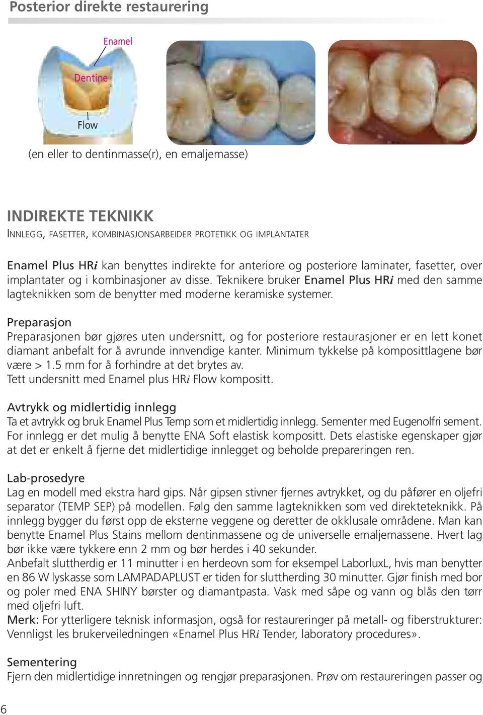 Teknikere bruker Enamel Plus HRi med den samme lagteknikken som de benytter med moderne keramiske systemer.