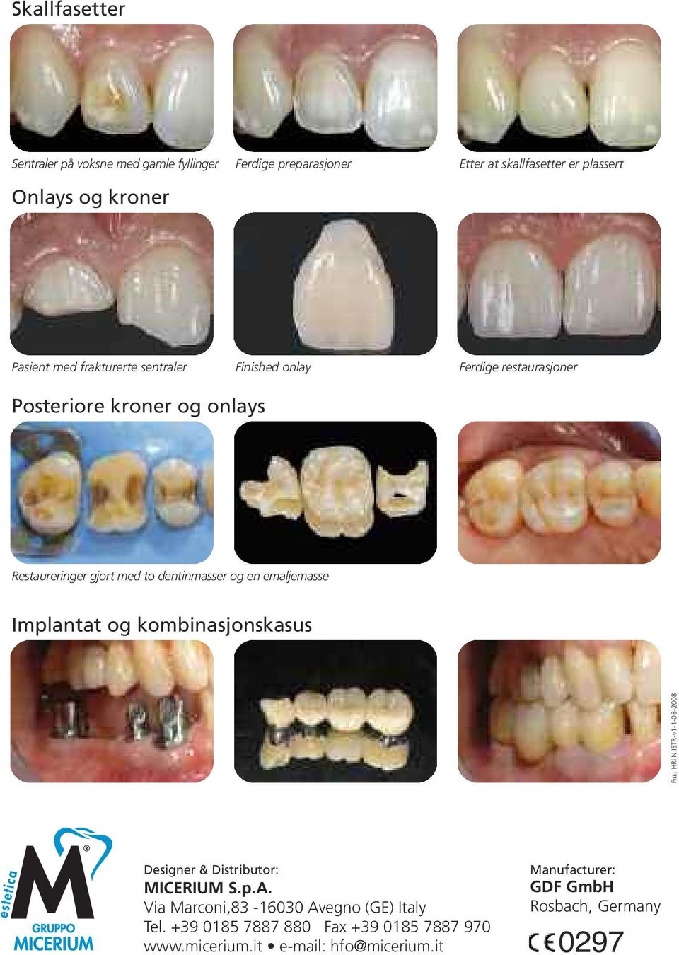 emaljemasse Implantat og kombinasjonskasus FILE: HRI N ISTR-V1-1-08-2008 Designer & Distributor: MICERIUM S.p.A.
