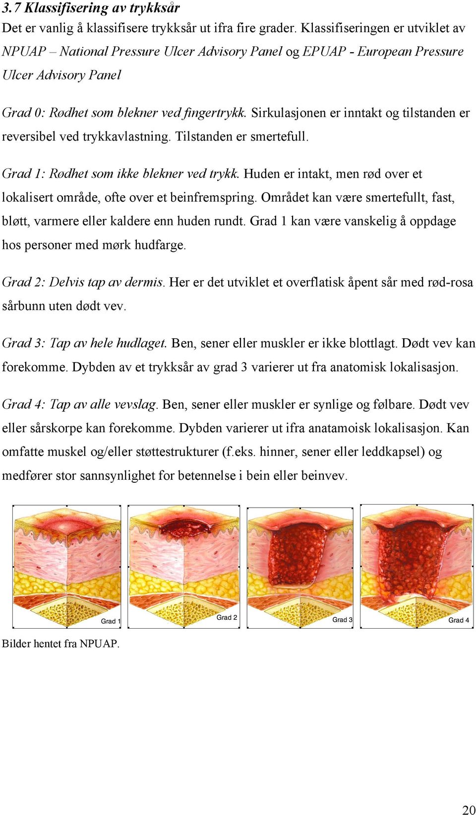 Sirkulasjonen er inntakt og tilstanden er reversibel ved trykkavlastning. Tilstanden er smertefull. Grad 1: Rødhet som ikke blekner ved trykk.