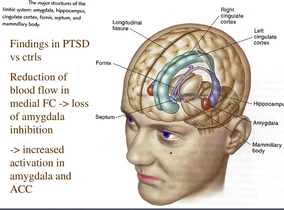 FC -> loss of amygdala inhibition