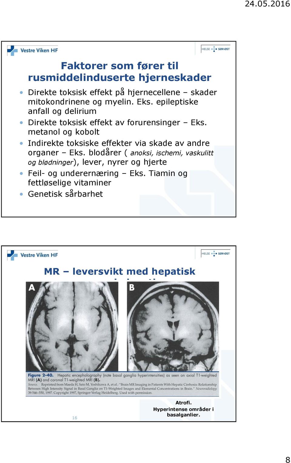 metanol og kobolt Indirekte toksiske effekter via skade av andre organer Eks.