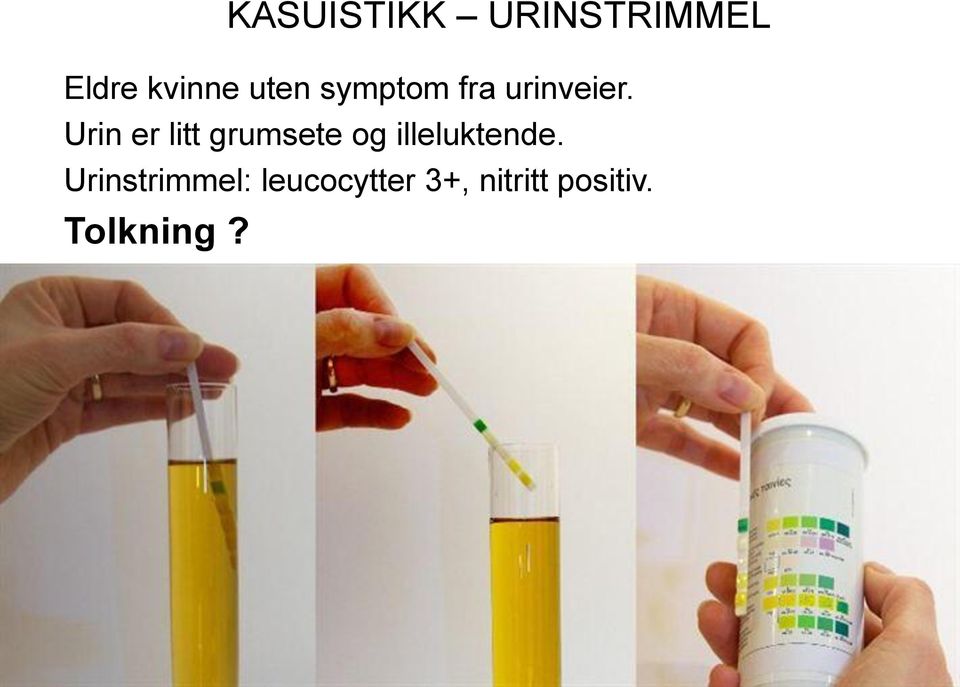 Urin er litt grumsete og illeluktende.