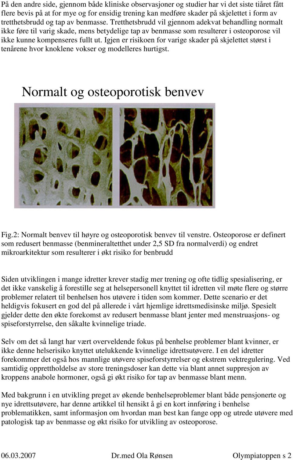 Tretthetsbrudd vil gjennom adekvat behandling normalt ikke føre til varig skade, mens betydelige tap av benmasse som resulterer i osteoporose vil ikke kunne kompenseres fullt ut.