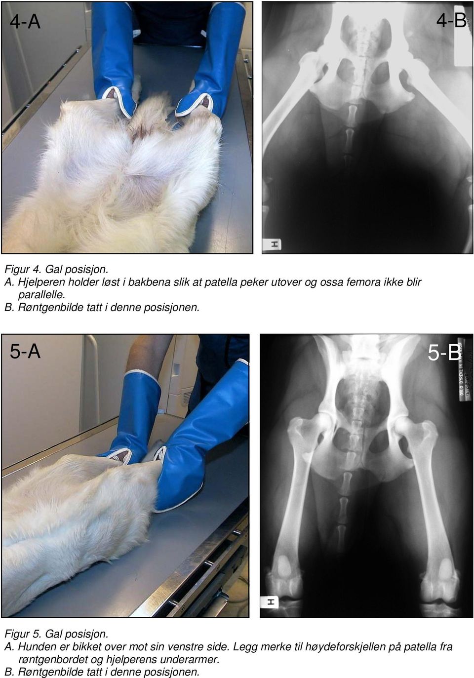 parallelle. B. Røntgenbilde tatt i denne posisjonen. 5-A 5-B Figur 5. Gal posisjon. A.