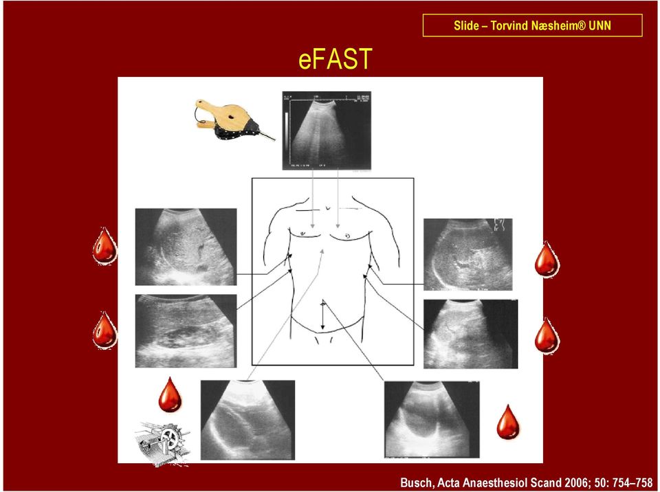 Acta Anaesthesiol