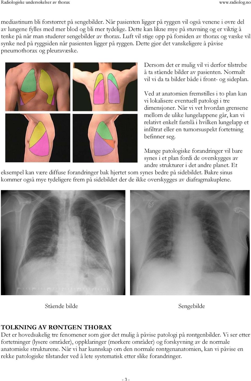 Luft vil stige opp på forsiden av thorax og væske vil synke ned på ryggsiden når pasienten ligger på ryggen. Dette gjør det vanskeligere å påvise pneumothorax og pleuravæske.