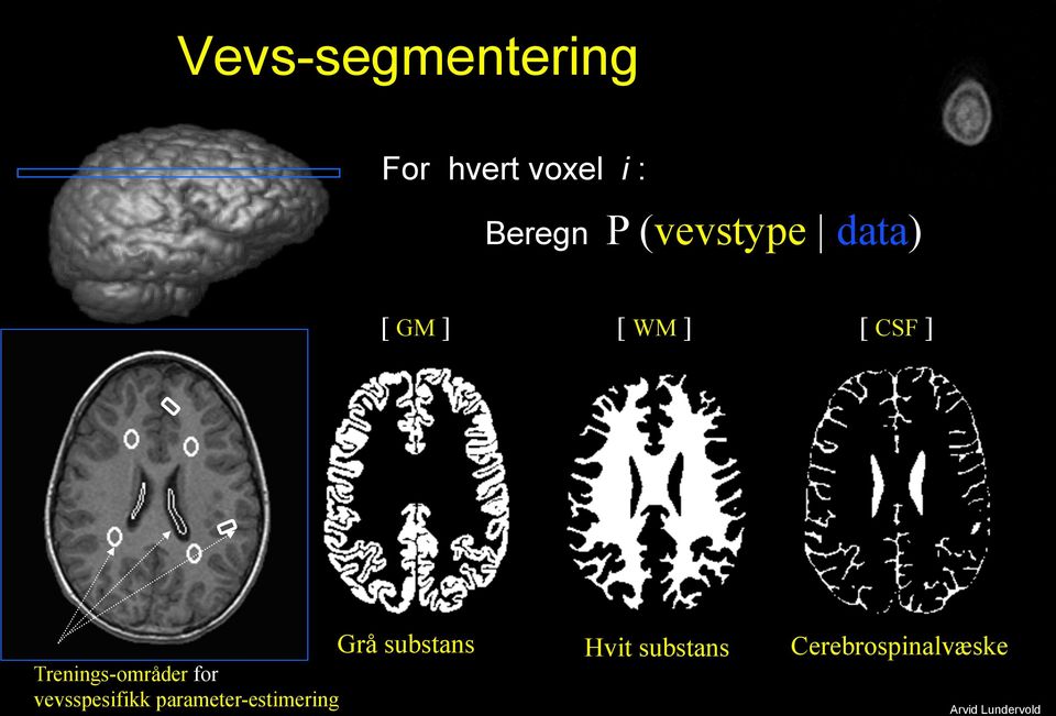 Trenings-områder for vevsspesifikk