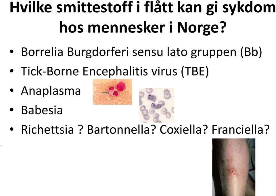 . Borrelia Burgdorferi sensu lato gruppen (Bb)