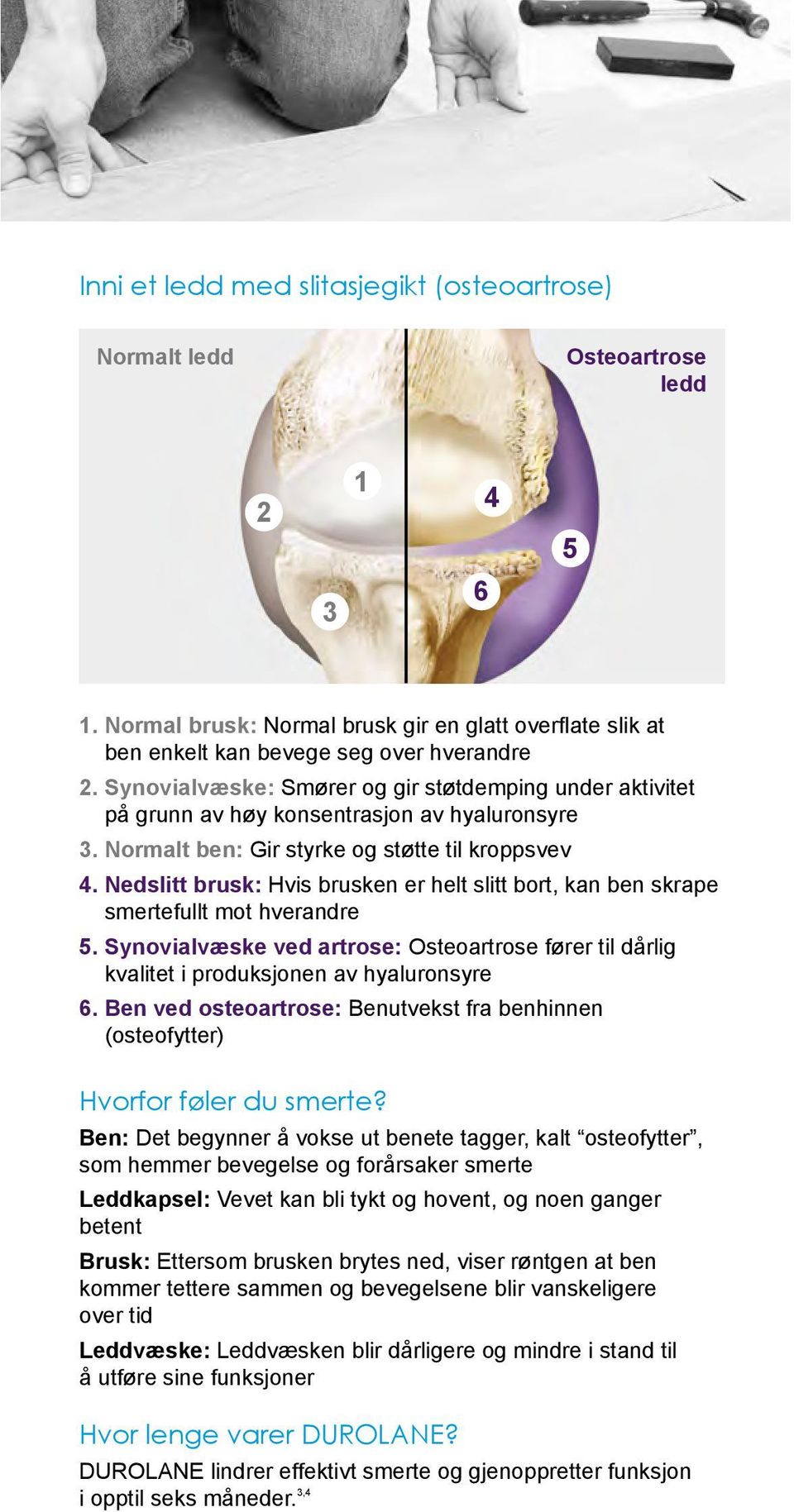 Nedslitt brusk: Hvis brusken er helt slitt bort, kan ben skrape smertefullt mot hverandre 5. Synovialvæske ved artrose: Osteoartrose fører til dårlig kvalitet i produksjonen av hyaluronsyre 6.